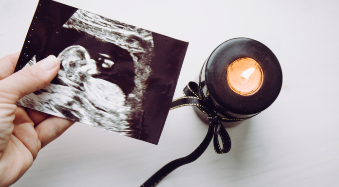 Holding a sonogram photo after a loss.