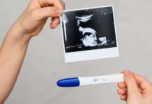 A pregnancy test and ultrasound picture.
