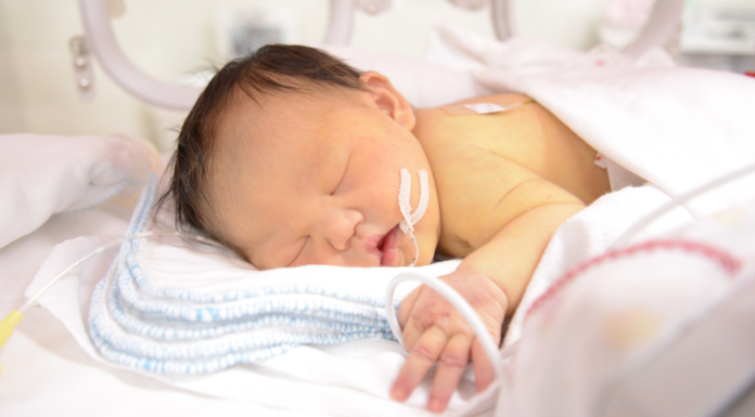 A baby in the NICU