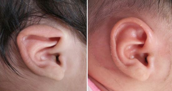 Ear molding