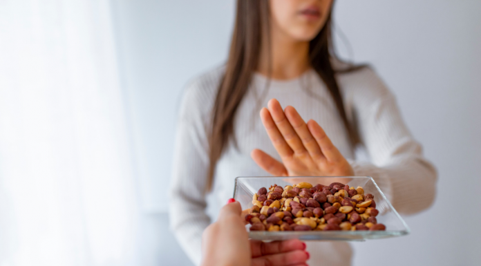 food allergies
