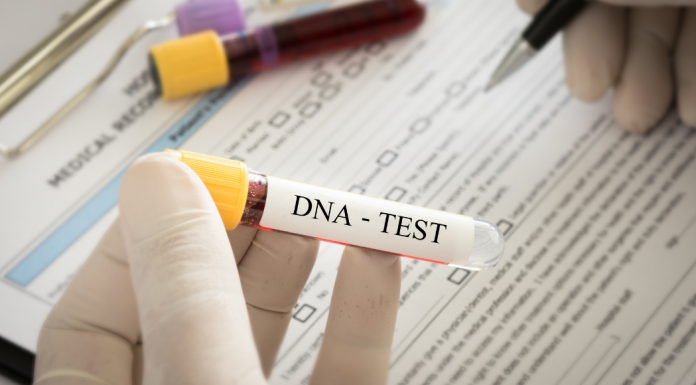 DNA test results.