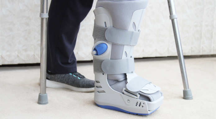 A broken foot in a boot.