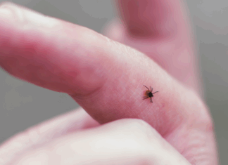 A tick on someone's finger.