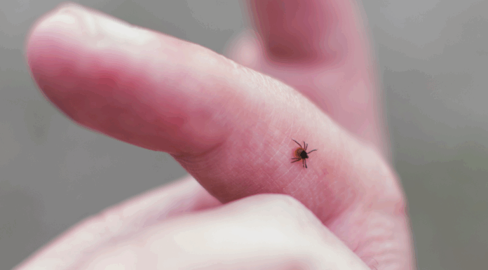 A tick on someone's finger.